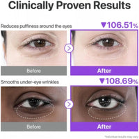 Numbuzin No. 9 NAD+ Collagen Under Eye Patches 5 Pairs