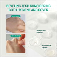 Some By Mi 30 Days Miracle Intensive Clear Spot Patches - Pack Of 18