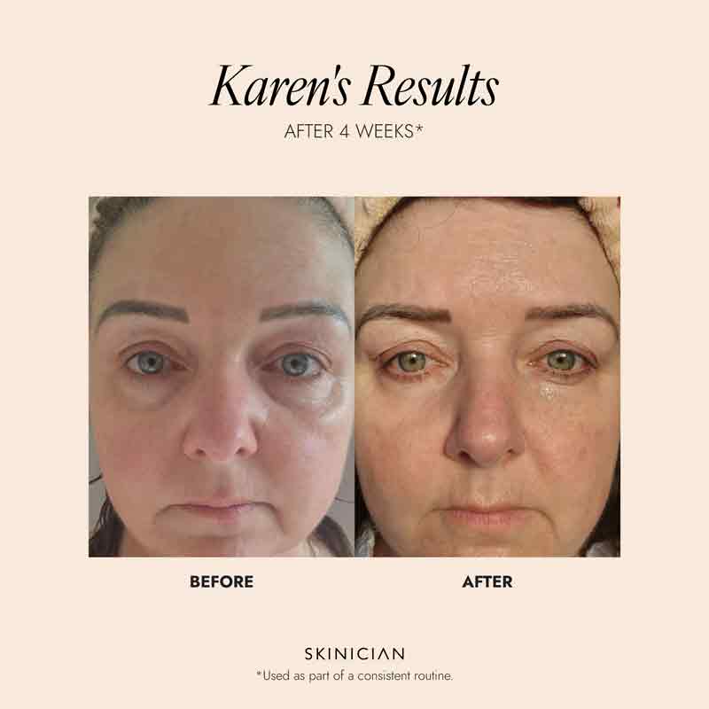 SKINICIAN Peptide Eye Complex Cream 15ml
