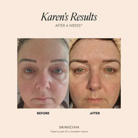 SKINICIAN Peptide Eye Complex Cream 15ml
